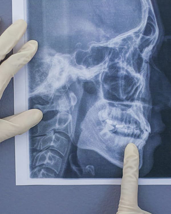 Oral Surgery